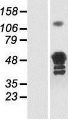 Western Blot: Glutamine Synthetase Overexpression Lysate [NBP2-11602]