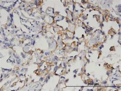 Immunohistochemistry-Paraffin: Glutaminyl-peptide Cyclotransferase/QPCT Antibody (3G2) [H00025797-M02]