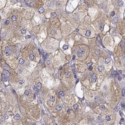 Immunohistochemistry: Glutaminyl-peptide Cyclotransferase/QPCT Antibody [NBP1-81838]