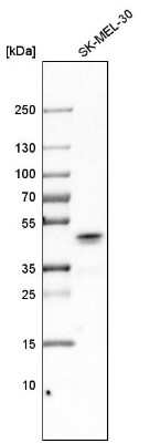 Western Blot: Glutaminyl-peptide Cyclotransferase/QPCT Antibody [NBP1-81838]