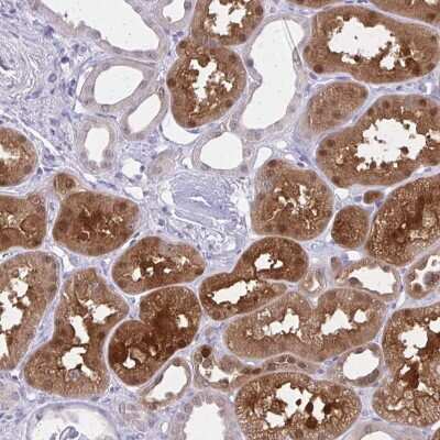 Immunohistochemistry-Paraffin: Glutaredoxin 1/GLRX1 Antibody [NBP2-55346]
