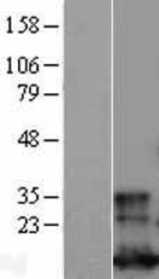 Western Blot: Glutaredoxin 1/GLRX1 Overexpression Lysate [NBL1-11124]