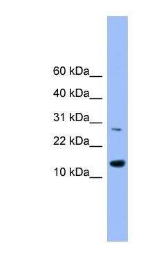 Western Blot: Glutaredoxin 2 Antibody [NBP1-79689]