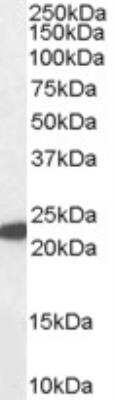 Western Blot: Glutathione Peroxidase 1/GPX1 Antibody [NB100-40805]