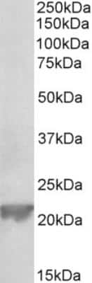 Western Blot: Glutathione Peroxidase 1/GPX1 Antibody [NBP2-26155]