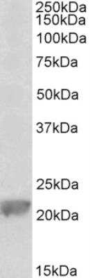 Western Blot: Glutathione Peroxidase 1/GPX1 Antibody [NBP2-26156]