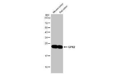 Western Blot: Glutathione Peroxidase 2/GPX2 Antibody (HL125) [NBP3-13662]