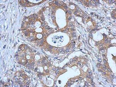 Immunohistochemistry-Paraffin: Glutathione Peroxidase 2/GPX2 Antibody [NBP1-32002]