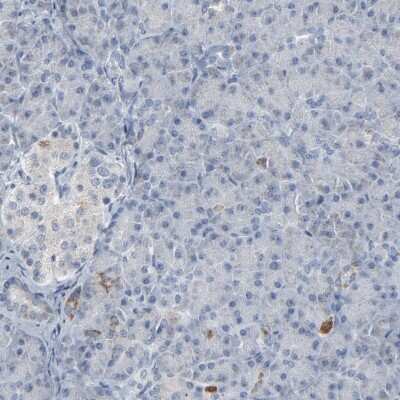 Immunohistochemistry-Paraffin: Glutathione Peroxidase 2/GPX2 Antibody [NBP2-47447]