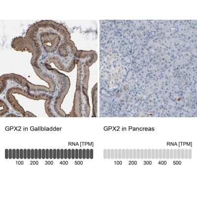 Immunohistochemistry-Paraffin: Glutathione Peroxidase 2/GPX2 Antibody [NBP2-47447]