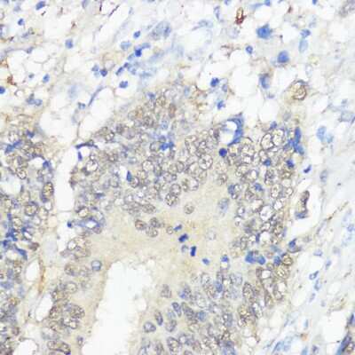 Immunohistochemistry-Paraffin: Glutathione Peroxidase 2/GPX2 Antibody - Azide and BSA Free [NBP3-03209]