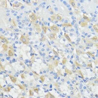 Immunohistochemistry-Paraffin: Glutathione Peroxidase 2/GPX2 Antibody - Azide and BSA Free [NBP3-03209]
