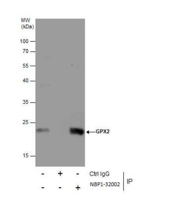 Immunoprecipitation: Glutathione Peroxidase 2/GPX2 Antibody [NBP1-32002]