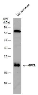Western Blot: Glutathione Peroxidase 2/GPX2 Antibody [NBP1-32002]