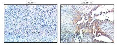 Immunohistochemistry: Glutathione Peroxidase 3/GPX3 Antibody [NBP1-06398]