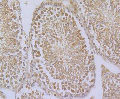 Immunohistochemistry: Glutathione Peroxidase 4/GPX4 Antibody [NBP2-76933]