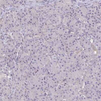 Immunohistochemistry-Paraffin: Glutathione Peroxidase 4/GPX4 Antibody [NBP2-54979]