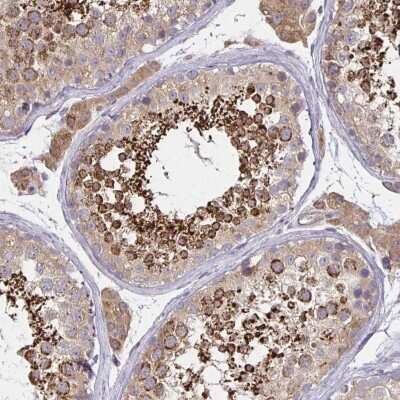 Immunohistochemistry-Paraffin: Glutathione Peroxidase 4/GPX4 Antibody [NBP2-54979]