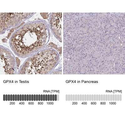 Immunohistochemistry-Paraffin: Glutathione Peroxidase 4/GPX4 Antibody [NBP2-54979]