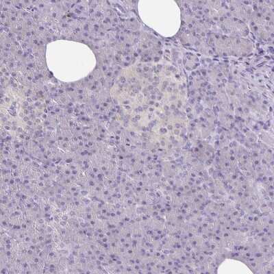 Immunohistochemistry-Paraffin: Glutathione Peroxidase 4/GPX4 Antibody [NBP2-56139]