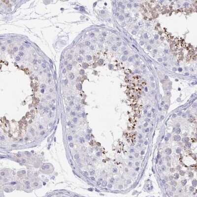 Immunohistochemistry-Paraffin: Glutathione Peroxidase 4/GPX4 Antibody [NBP2-56139]