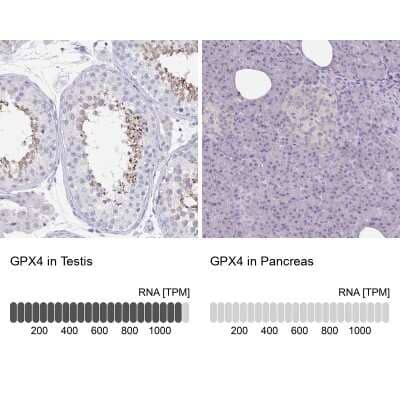 Immunohistochemistry-Paraffin: Glutathione Peroxidase 4/GPX4 Antibody [NBP2-56139]