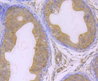 Immunohistochemistry-Paraffin: Glutathione Peroxidase 4/GPX4 Antibody (JU11-31) [NBP2-75511]