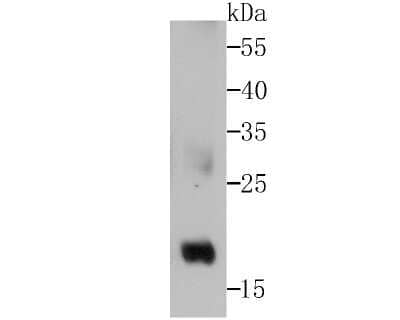 Western Blot: Glutathione Peroxidase 4/GPX4 Antibody (JU11-31) [NBP2-75511]