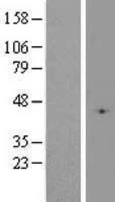 Western Blot: Glutathione Peroxidase 4/GPX4 Overexpression Lysate [NBP2-10796]