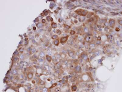 Immunohistochemistry-Paraffin: Glutathione Peroxidase 7 Antibody [NBP1-31474]