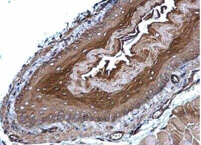 Immunohistochemistry-Paraffin: Glutathione Peroxidase 7 Antibody [NBP1-31474]