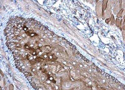 Immunohistochemistry-Paraffin: Glutathione Peroxidase 7 Antibody [NBP1-31924]