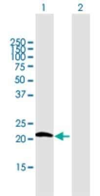 Western Blot: Glutathione Peroxidase 7 Antibody [H00002882-B01P]