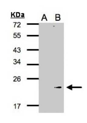 Western Blot: Glutathione Peroxidase 7 Antibody [NBP1-31474]