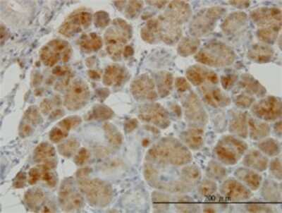 Immunohistochemistry-Paraffin: Glutathione Reductase Antibody (6B4) [H00002936-M01]