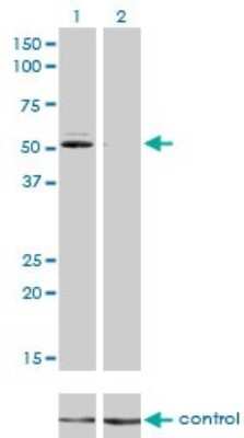 Western Blot: Glutathione Reductase Antibody (6B4) [H00002936-M01]