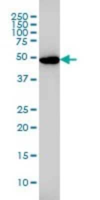 Western Blot: Glutathione Reductase Antibody (6B4) [H00002936-M01]