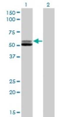 Western Blot: Glutathione Reductase Antibody (6B4) [H00002936-M01]