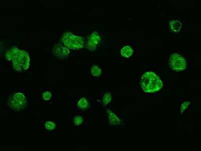 Immunocytochemistry/ Immunofluorescence: Glutathione Reductase Antibody [NBP2-99476]