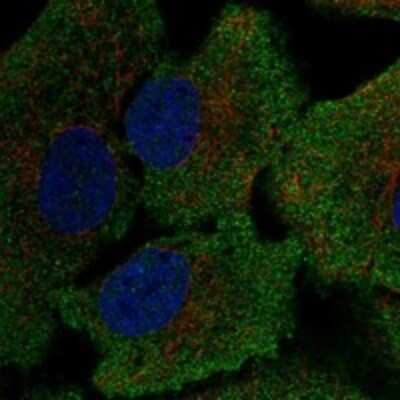 Immunocytochemistry/ Immunofluorescence: Glutathione Reductase Antibody [NBP3-17718]