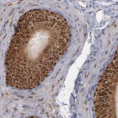 Immunohistochemistry: Glutathione Reductase Antibody [NBP1-88118]