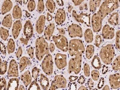 Immunohistochemistry-Paraffin: Glutathione Reductase Antibody [NBP2-97945]