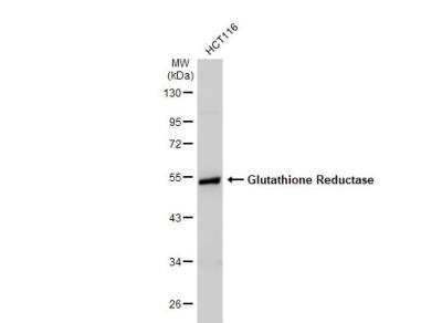 Western Blot: Glutathione Reductase Antibody [NBP2-16684]