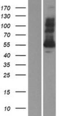 Western Blot: Glutathione Reductase Overexpression Lysate [NBP2-10688]