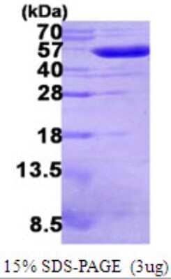 SDS-PAGE: Recombinant E. coli Glutathione Reductase His Protein [NBP2-22639]