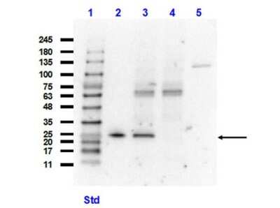 Western Blot: Glutathione S-Transferase/GST Antibody (GST13)VHH [NBP3-12166]