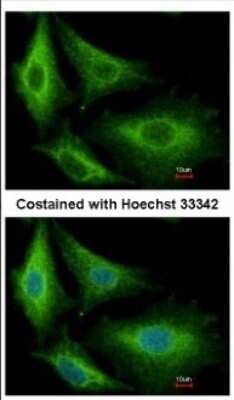 Immunocytochemistry/ Immunofluorescence: Glutathione S Transferase kappa 1 Antibody [NBP2-16686]
