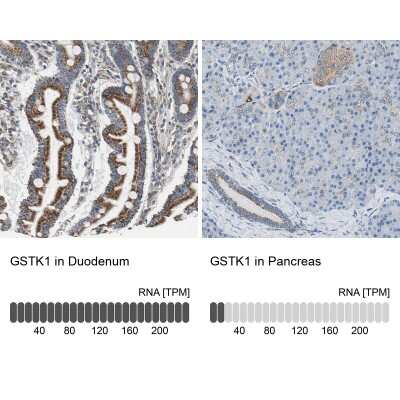 Immunohistochemistry-Paraffin: Glutathione S Transferase kappa 1 Antibody [NBP1-89727]