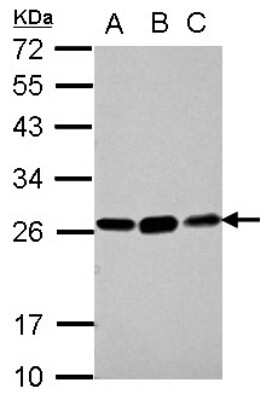 Western Blot: Glutathione S Transferase kappa 1 Antibody [NBP2-16685]