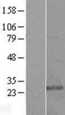 Western Blot: Glutathione S Transferase kappa 1 Overexpression Lysate [NBL1-11371]